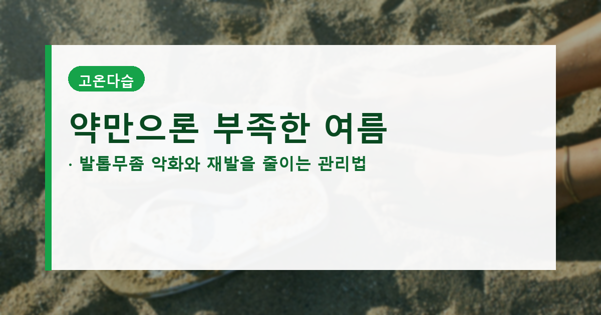 여름철 발톱무좀 관리법을 보여주는 발 건강 루틴 대표 배너