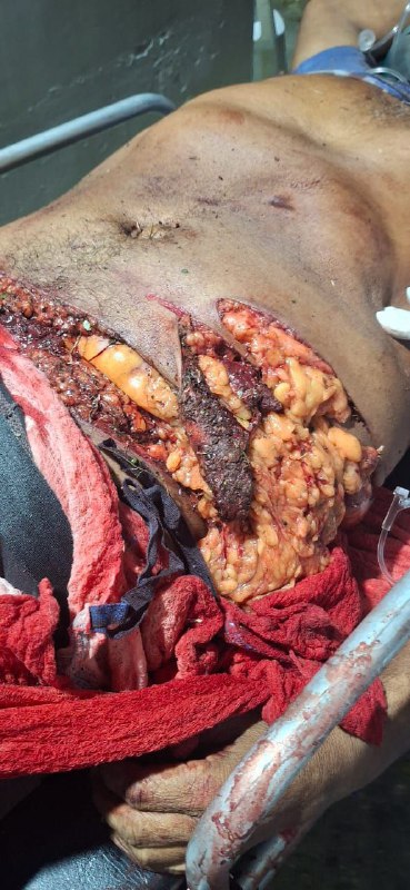 Khu vực tổ chức lễ hội đấu bò