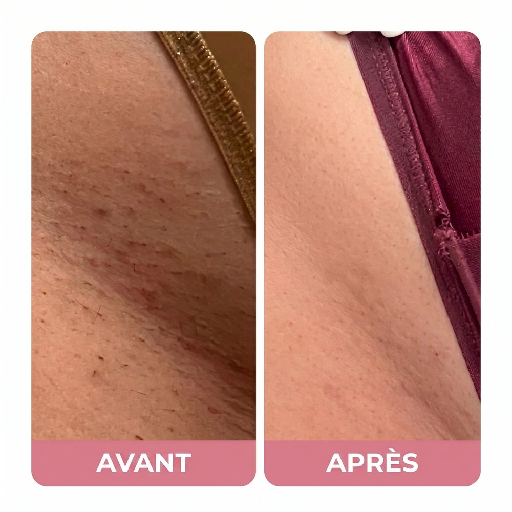 Avant / Après — Sara M.
