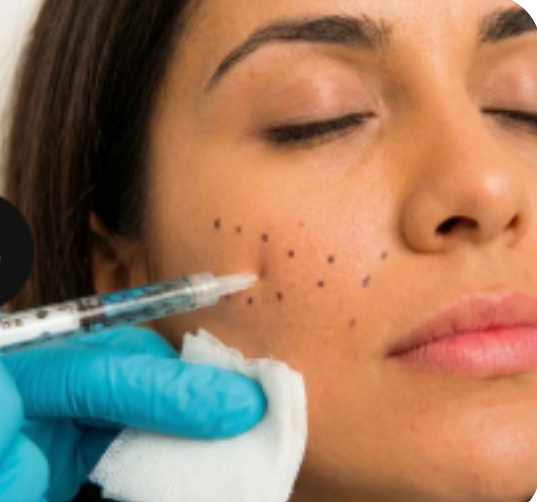 Botox Image Right