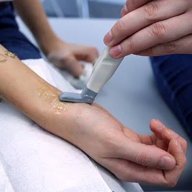 Private Hand And Wrist Ultrasound Scan | Private Ultrasound Scans And Health Checks | London Private Ultrasound Hand or wrist ultrasound scan at London Private Ultrasound