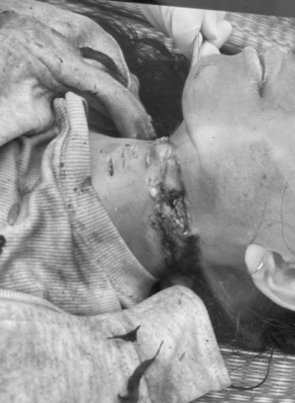 Công an khám nghiệm hiện trường