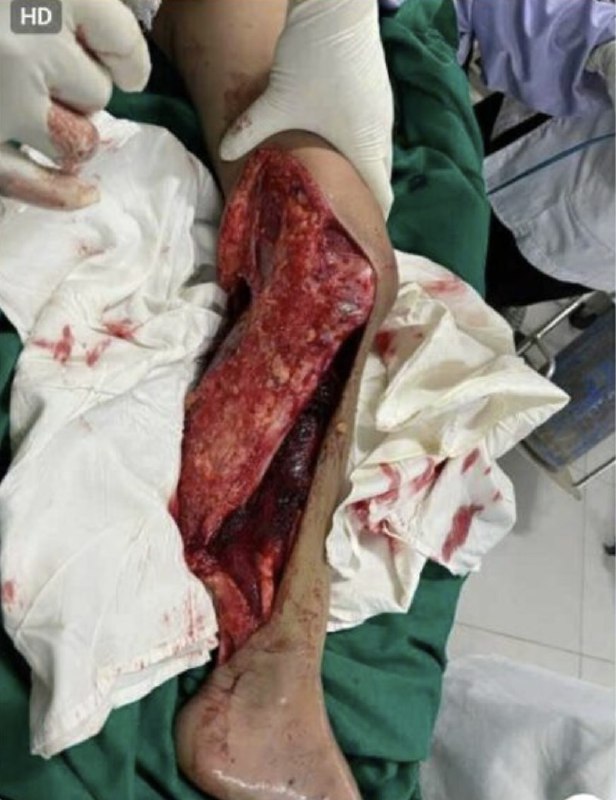 Hình ảnh liên quan vụ tai nạn