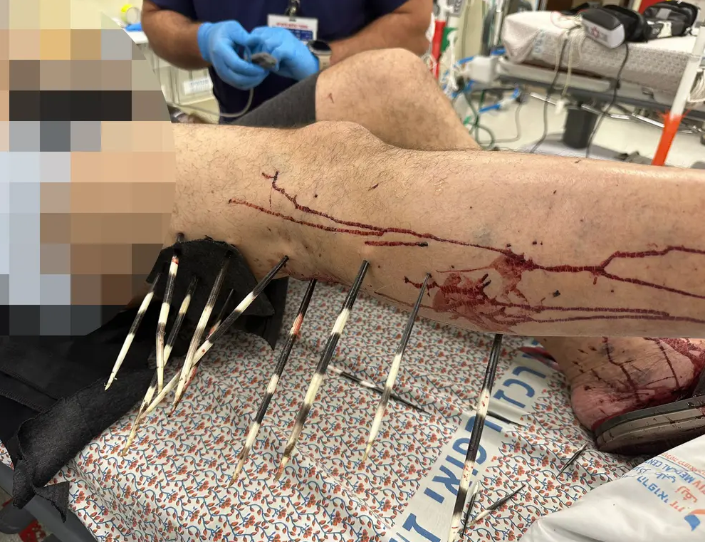 Nạn nhân bị thương