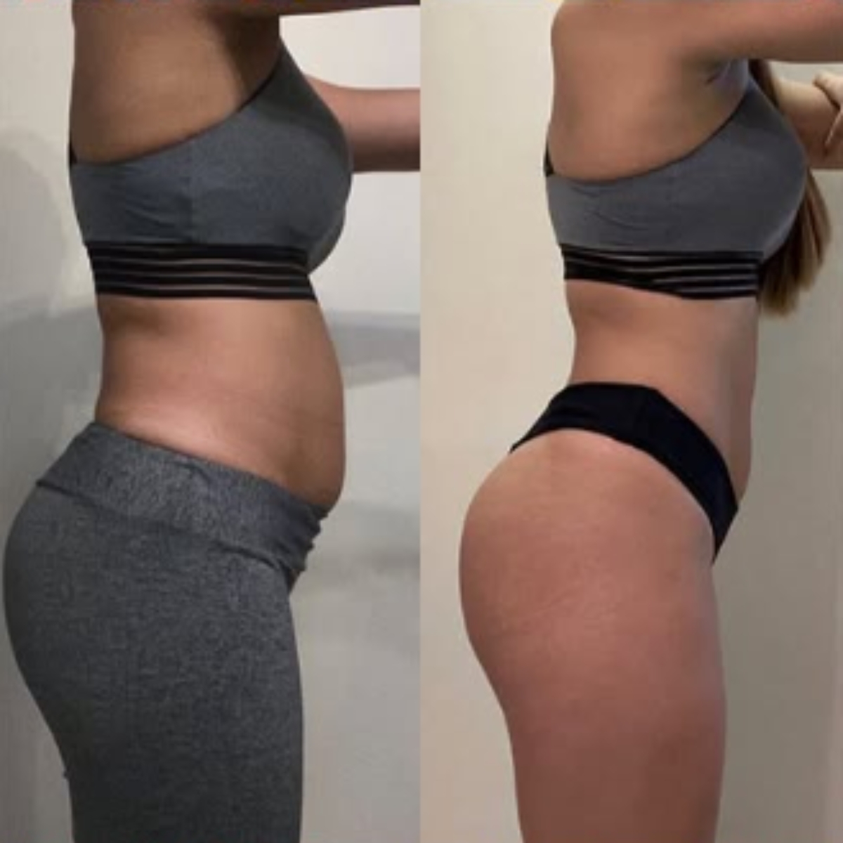 Antes e depois com Drenexx 2