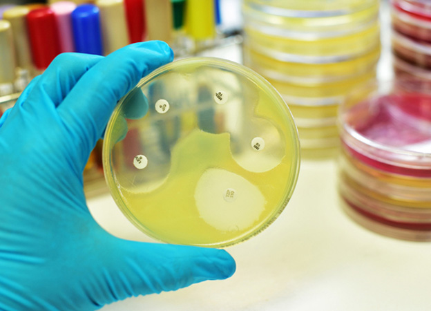 Urine sample being prepared for laboratory culture