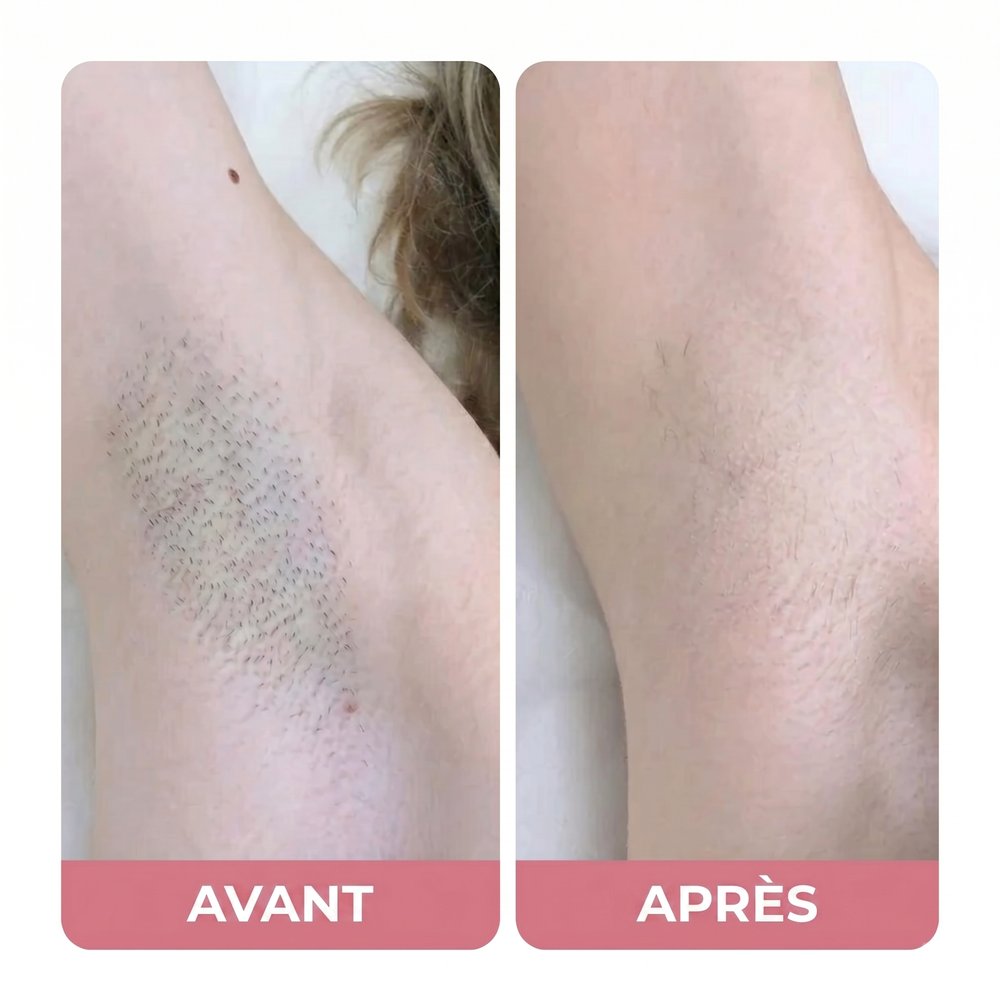 Avant / Après — Ana T.