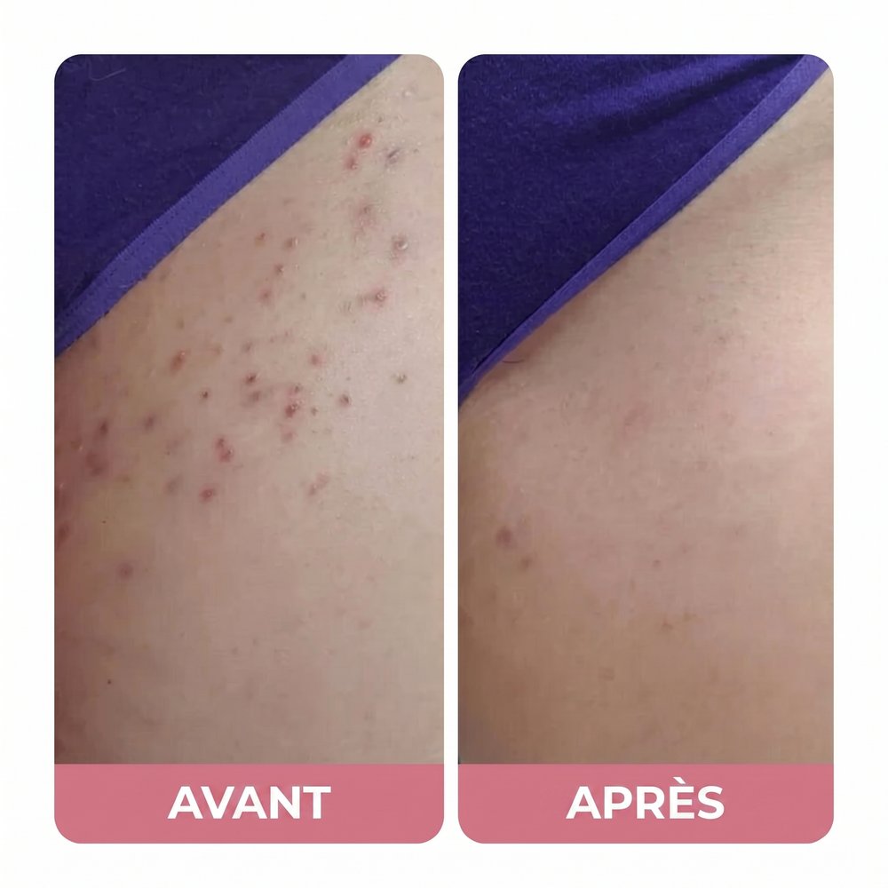 Avant / Après — Marta G.
