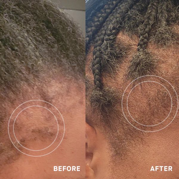 THICKR before and after — Queen E., visibly denser edges