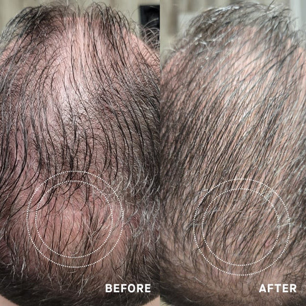 THICKR before and after — Ken B., visibly fuller crown