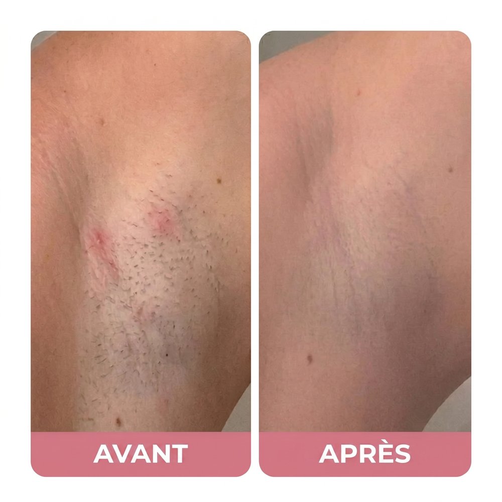 Avant / Après — Elena V.