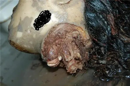 Hình hiện trường 9