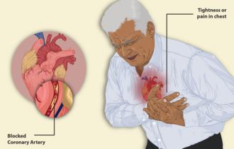 Sign 9: Inner Left Arm Heaviness and Aching