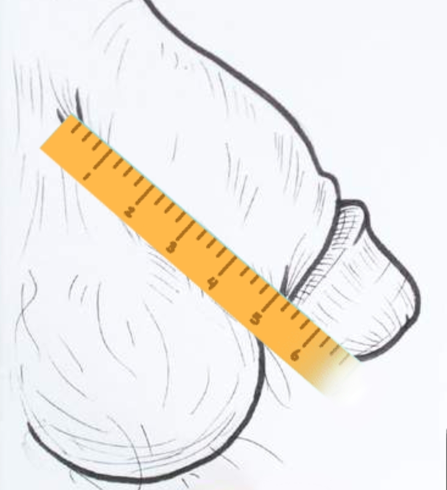 Flaccid Length Measurement