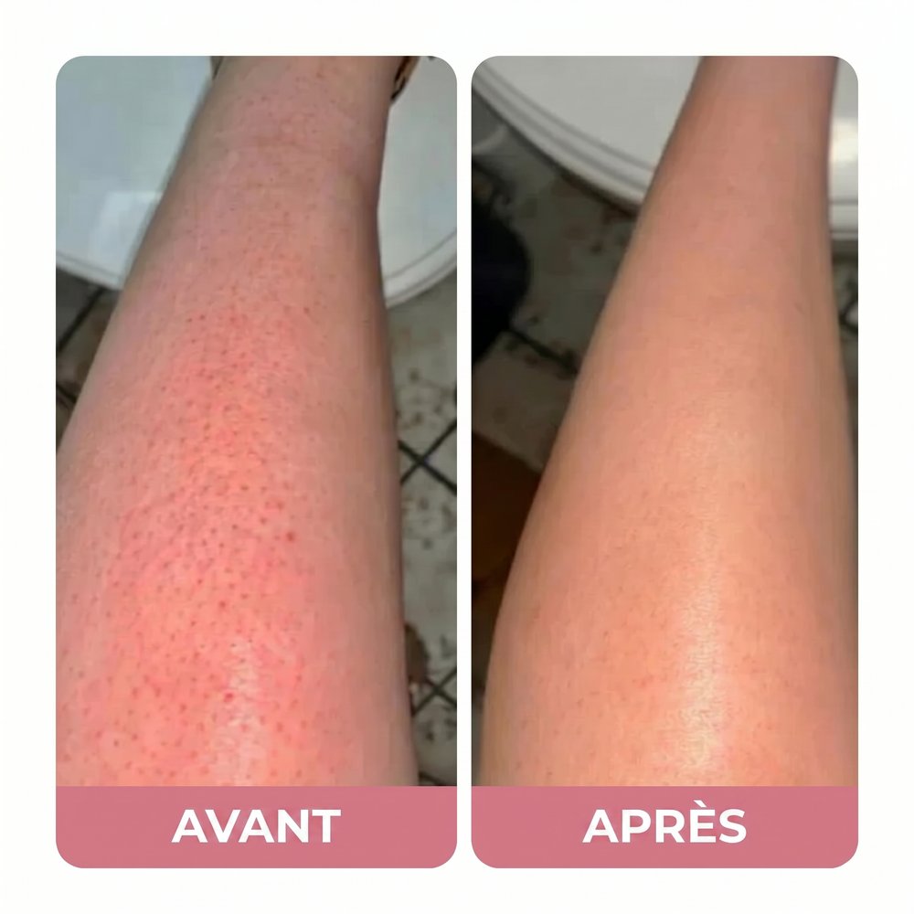 Avant / Après — Lucie P.