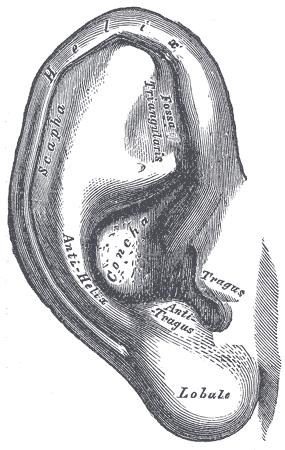 Sign 7: Frank's Sign: The Diagonal Earlobe Crease