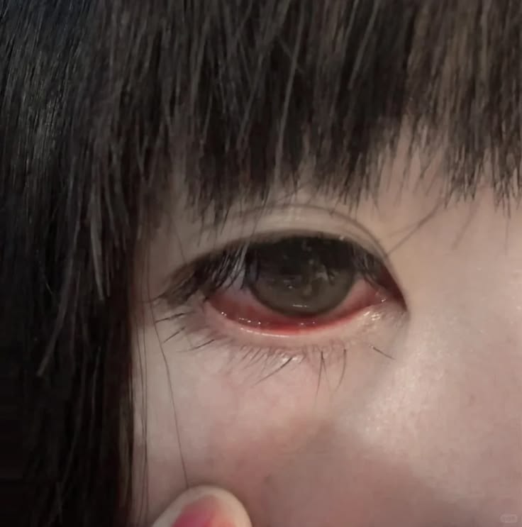 eye