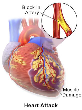 Sign 28: The Radiating Triad: Jaw, Neck, and Left Arm Convergence
