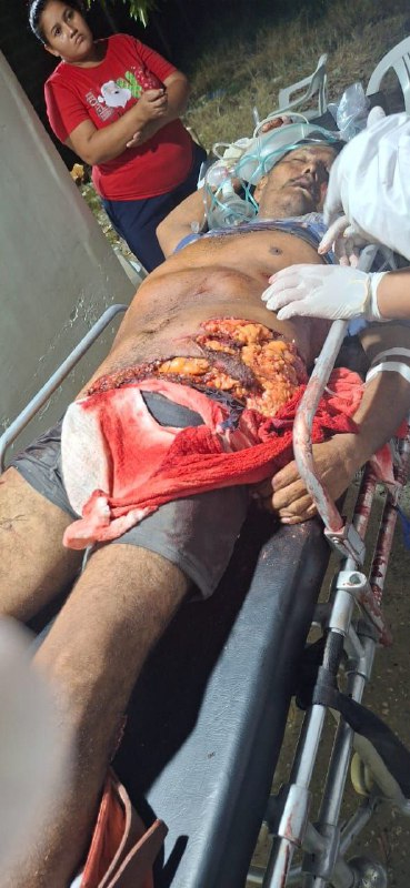 Hiện trường vụ bò húc tại Chimá