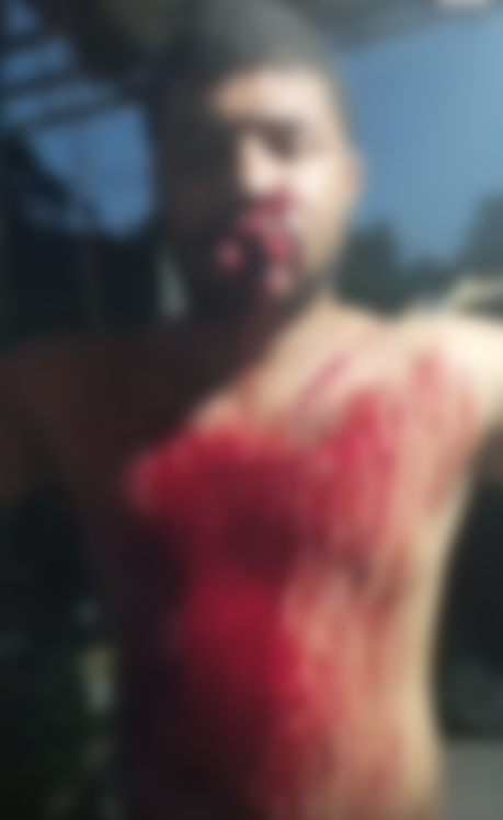 Hiện trường vụ ẩu đả tại Indonesia