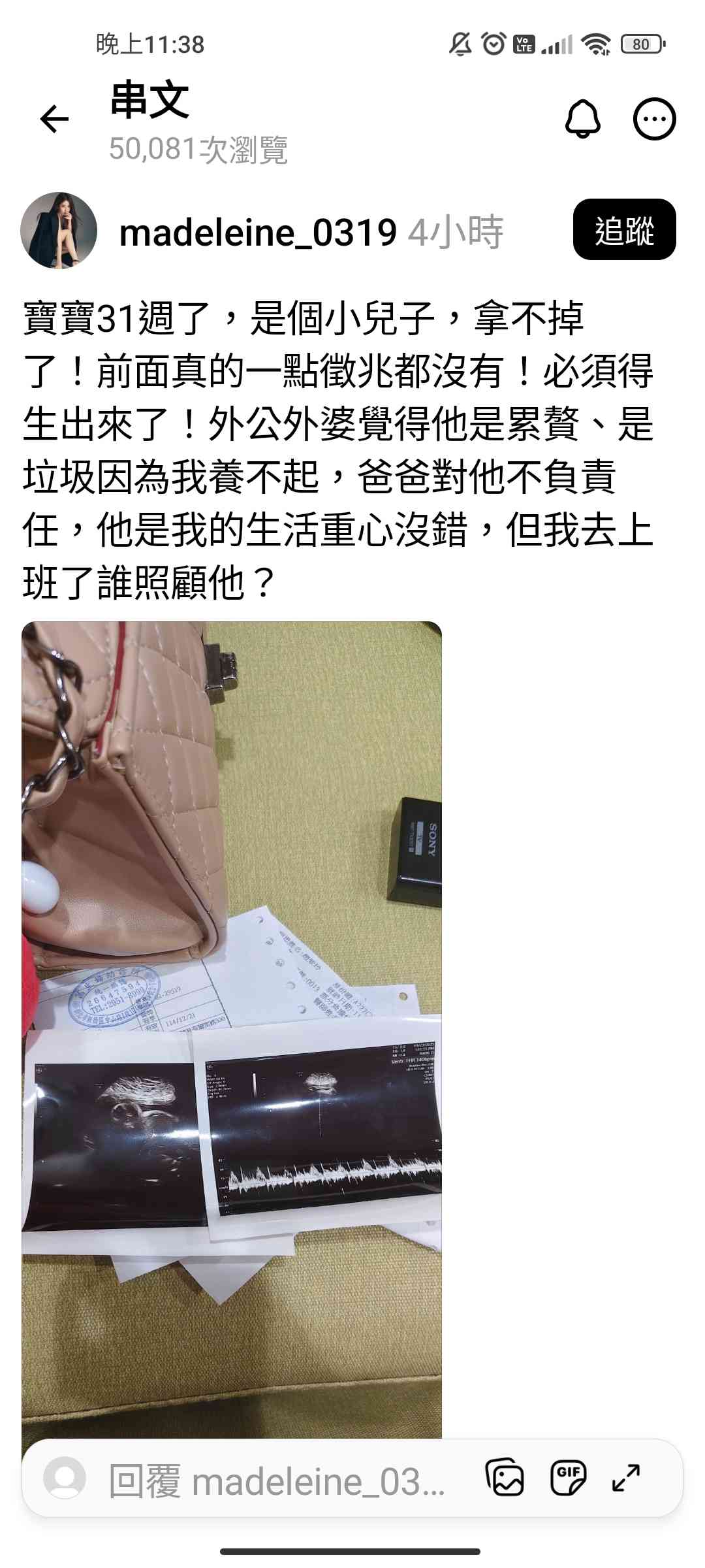 [問卦] 脆#寶寶31週了，沒錢養怎麼辦 