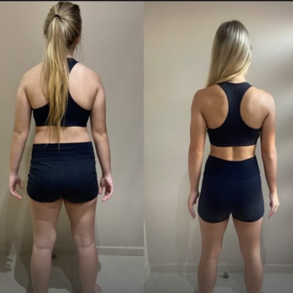 Antes e depois com Drenexx 4