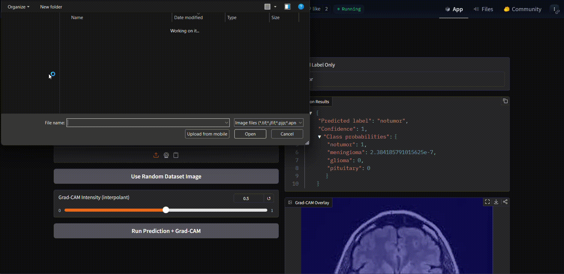 Brain_Tumor_Classification_with_InceptionV3-Grad-CAM