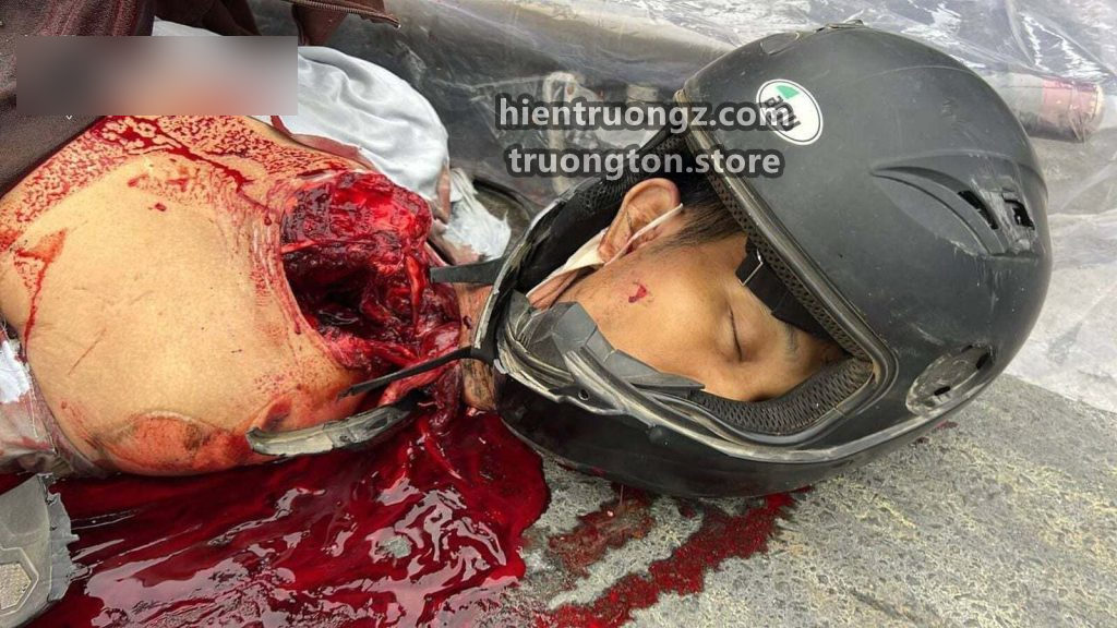 Công tác điều tra tai nạn giao thông