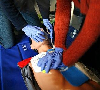 Sign 30: Vasovagal Syncope: Sudden Collapse or Blackout